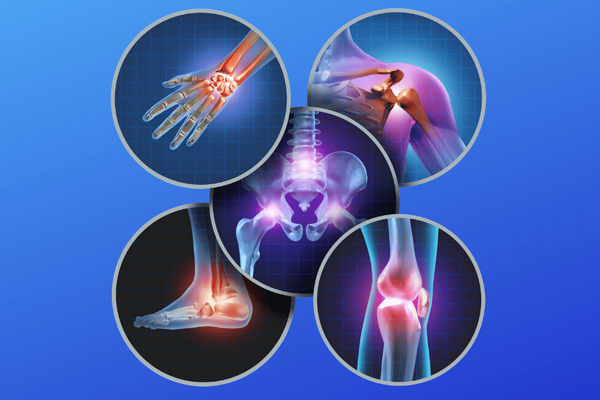 Orthopedics